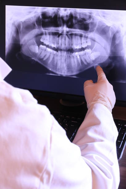 Best Emergency Treatment for Dental Infections or Abscesses in Spencer, OK